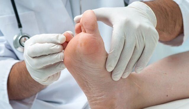 a gomba kezelése és diagnosztizálása orvos által