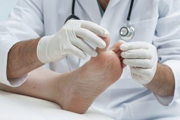 a lábgomba orvos általi diagnosztizálása