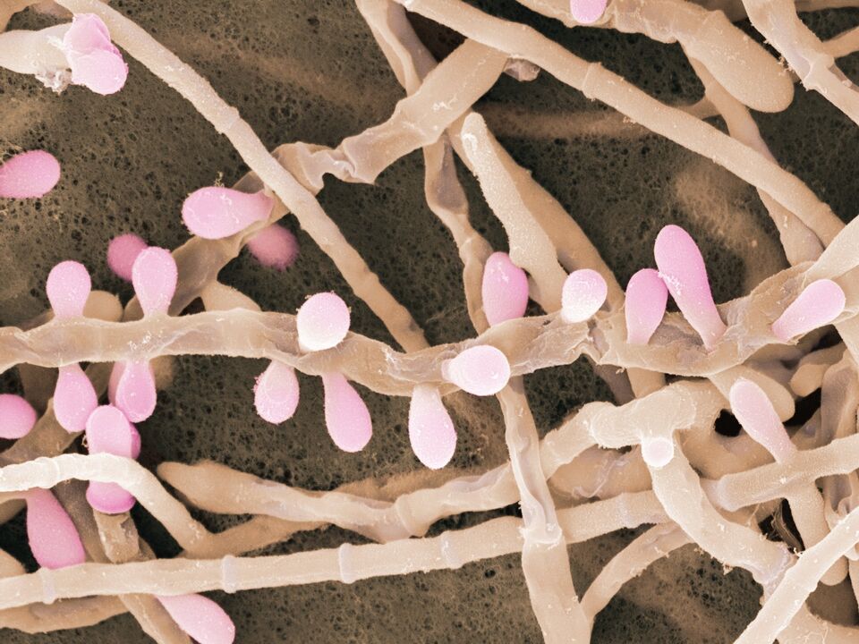 A Trichophyton rubrum egyfajta gomba, amely a lábbőrt érinti.